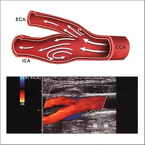 Inside Ultrasound Vascular Reference Guide - Sample Pages