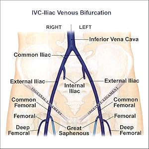 Inside Ultrasound Vascular Reference Guide - Content Preview