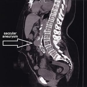 Inside Ultrasound Vascular Reference Guide - Additional Content