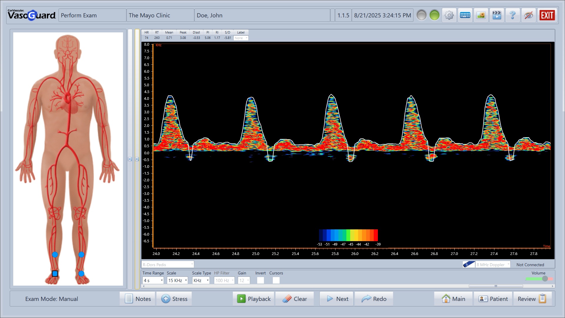 8MHz Doppler Waveform